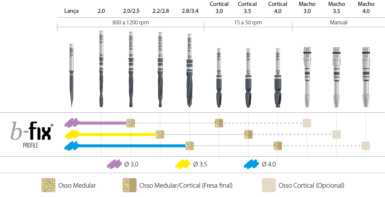 protocolo perfuração guidefix cirurgia guiada